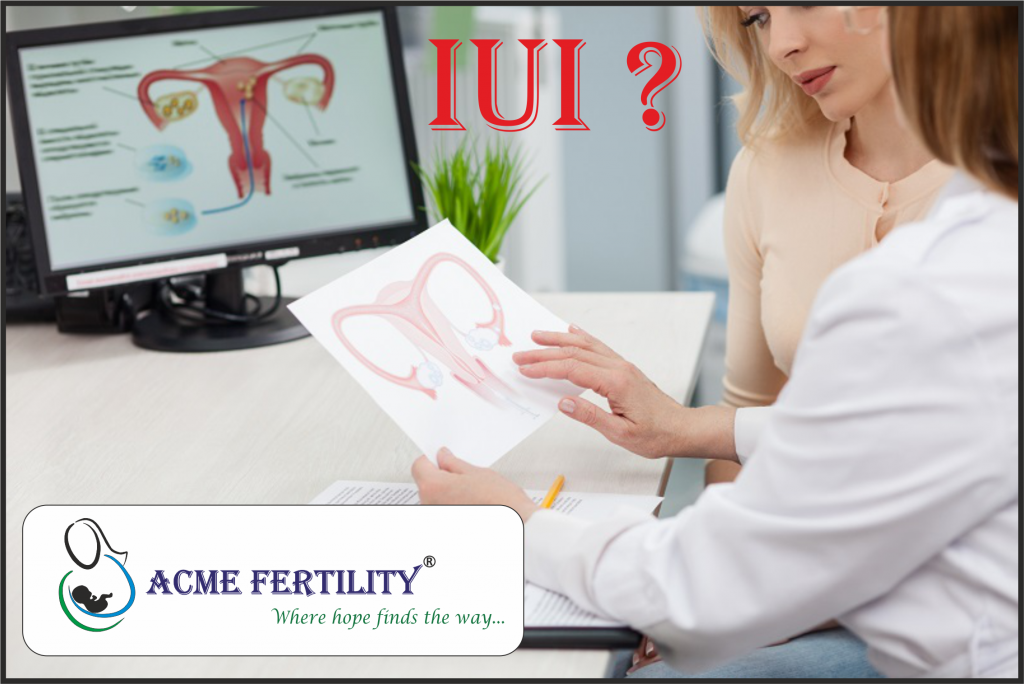 IUI IVF Blogs
